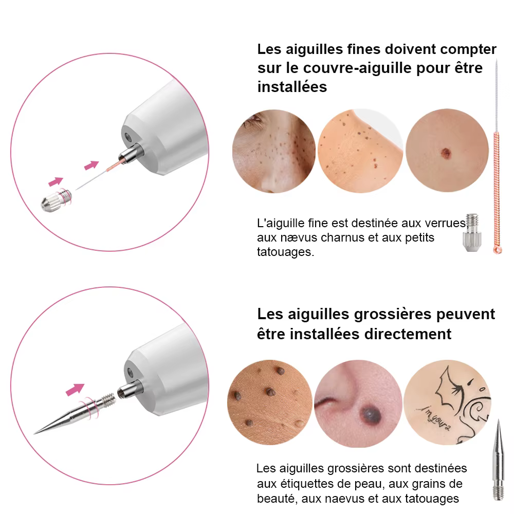 Appareil d'enlèvement des taches cutanées au plasma laser